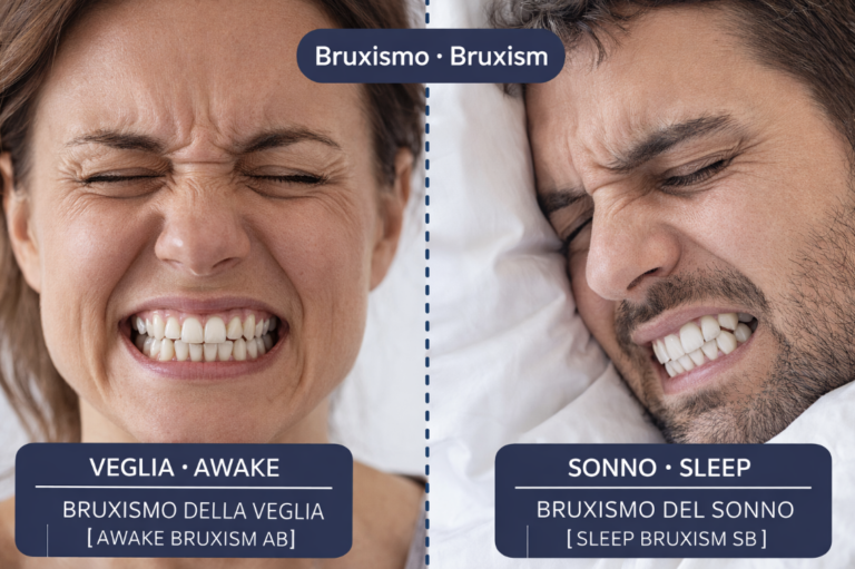 Il Bruxismo